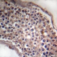 Ephrin B1/2 Rabbit Polyclonal Antibody