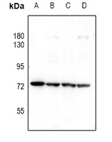 PKR Rabbit Polyclonal Antibody