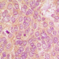 PKR Rabbit Polyclonal Antibody