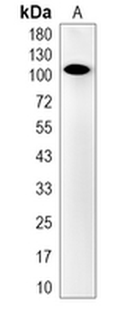 OSBPL1A Rabbit Monoclonal Antibody