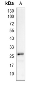SYPL1 Rabbit Monoclonal Antibody