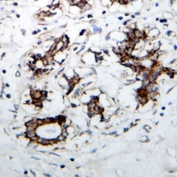 ACACB Rabbit Monoclonal Antibody