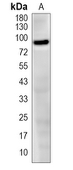 MDM2 Rabbit Monoclonal Antibody