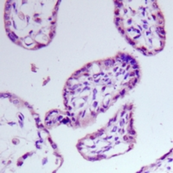 MDM2 Rabbit Monoclonal Antibody