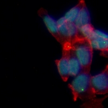 MDM2 Rabbit Monoclonal Antibody