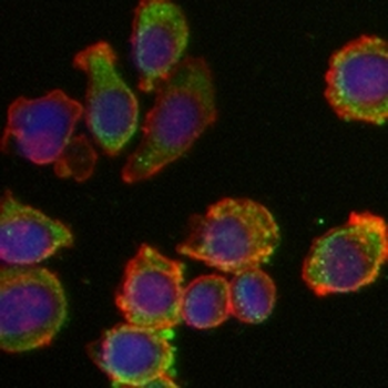 MCL1 Rabbit Monoclonal Antibody