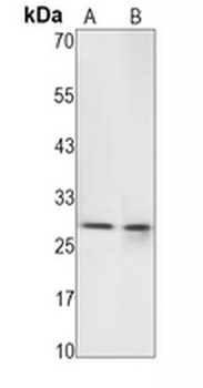 HLA-DRB1 Rabbit Monoclonal Antibody
