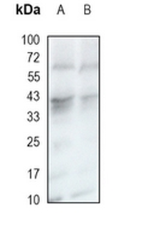 CRKL Rabbit Monoclonal Antibody