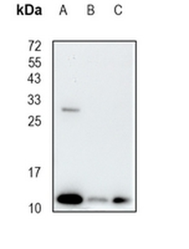 Cystatin A Rabbit Monoclonal Antibody