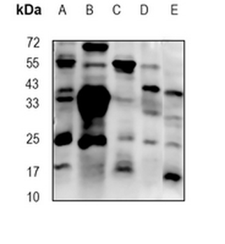 PRTN3 Rabbit Monoclonal Antibody
