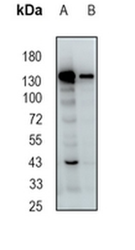 SMC4 Rabbit Monoclonal Antibody