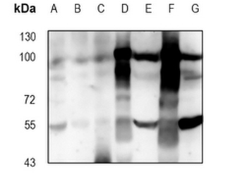ALDH1L1 Rabbit Monoclonal Antibody