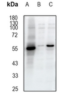 CBX2 Rabbit Monoclonal Antibody