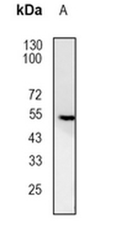 Glucokinase Rabbit Monoclonal Antibody