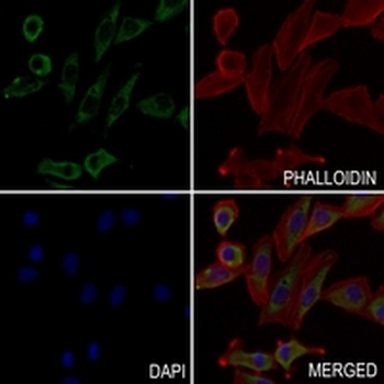 Presenilin 1 Rabbit Monoclonal Antibody