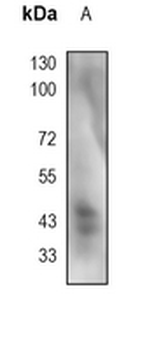 ERK1/2 (Phospho-T202+T185) Rabbit Monoclonal Antibody