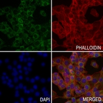 Factor IX Rabbit Monoclonal Antibody