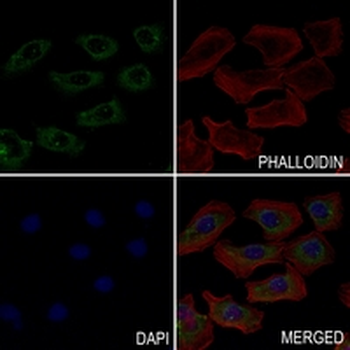 Cytochrome P450 2D6 Rabbit Monoclonal Antibody