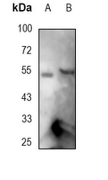 FOXA2 Rabbit Monoclonal Antibody