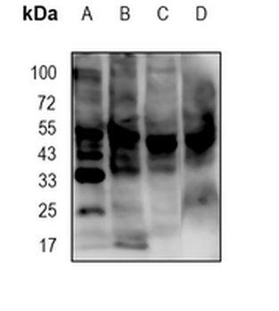 JNK1/2/3 (Phospho-T183+T183+T221) Rabbit Monoclonal Antibody