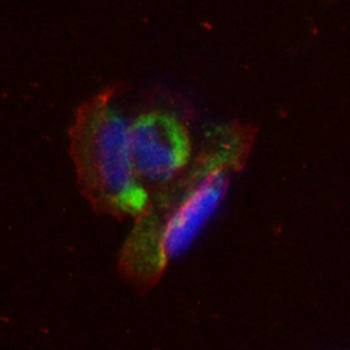 Osteopontin Rabbit Monoclonal Antibody