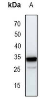 Arginase 1 Rabbit Monoclonal Antibody