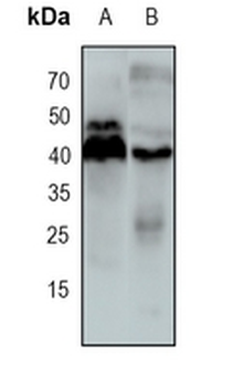 VEGFA Rabbit Monoclonal Antibody