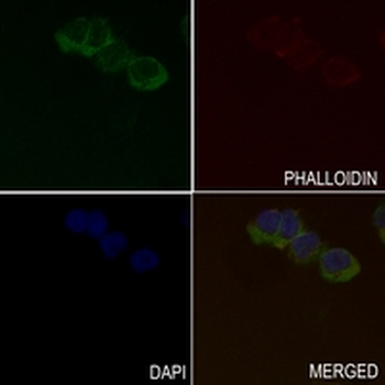 Aconitase 1 Rabbit Monoclonal Antibody