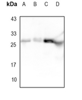 BCLX Rabbit Monoclonal Antibody