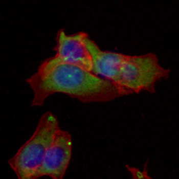 GSK3 beta Rabbit Monoclonal Antibody
