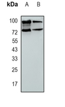 ERCC2 Rabbit Monoclonal Antibody