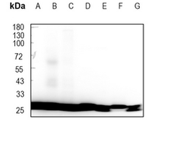 RPL7A Rabbit Monoclonal Antibody