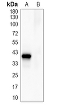 Flag-tag Mouse Monoclonal Antibody