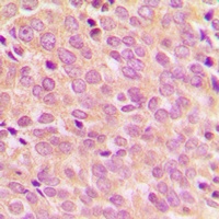 IRS1 (Phospho-S794) Antibody