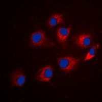 IRS1 (Phospho-S794) Antibody