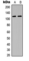 JAK3 Rabbit Polyclonal Antibody