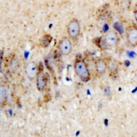 Kir3.1 (Phospho-S185) Antibody