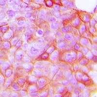 VEGFR2 (Phospho-Y951) Antibody