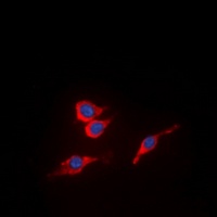 VEGFR2 (Phospho-Y951) Antibody