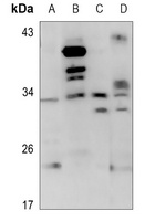 CD159a Rabbit Polyclonal Antibody