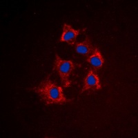 Cytokeratin 8 (Phospho-S432) Antibody
