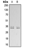 LAT (Phospho-Y200) Rabbit Polyclonal Antibody