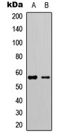 LCK (Phospho-Y505) Antibody