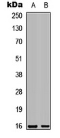 Galectin 7 Rabbit Polyclonal Antibody