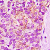 LYN (Phospho-Y397) Antibody