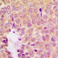 MKK1 (Phospho-S298) Antibody