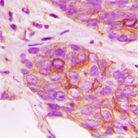 MKK3 (Phospho-T222) Antibody