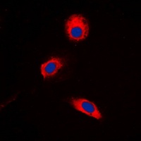 MKK3 (Phospho-T222) Antibody