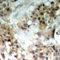 MKK7 (Phospho-S271) Antibody
