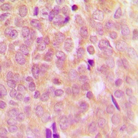 ASK1 (Phospho-S83) Antibody